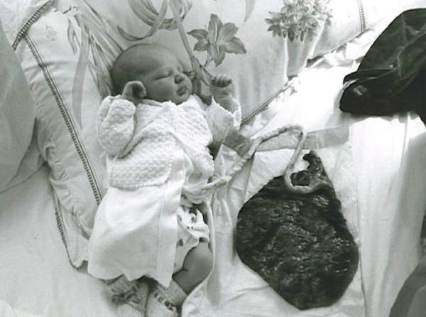 Lotus birth baby attached to placenta in black and white